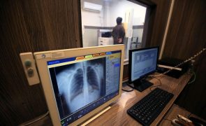 Setor convencionado de radiologia custou cerca de 132 milhões de euros em 2023