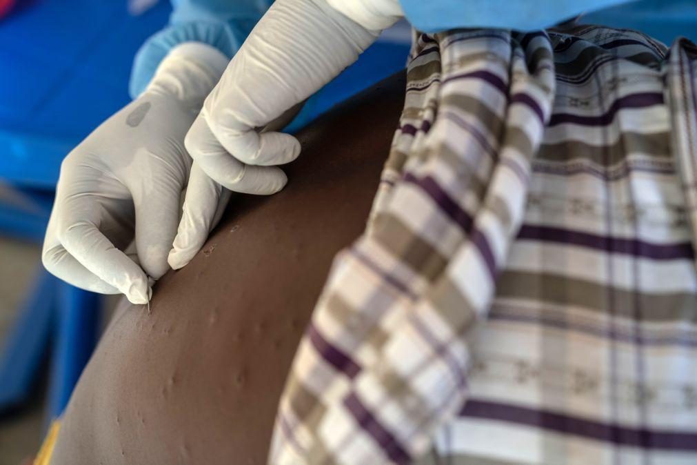 Espanha anuncia que vai doar 100 mil frascos de vacina contra mpox a países africanos