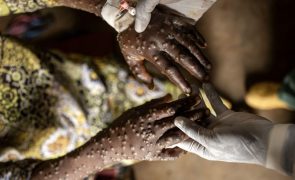 Mpox já infetou 38.300 pessoas e matou 979 desde o início do ano em África