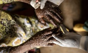 África regista 132.954 casos de mpox e 1.761 mortes desde o início de 2024
