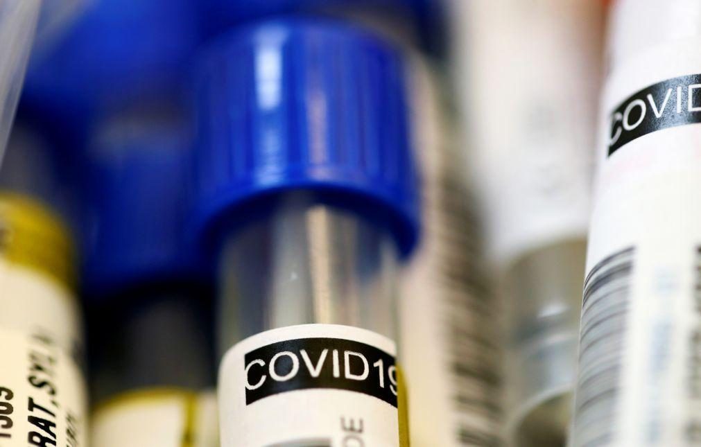 Covid-19: Foram realizados mais de 36.000 testes até 25 de março