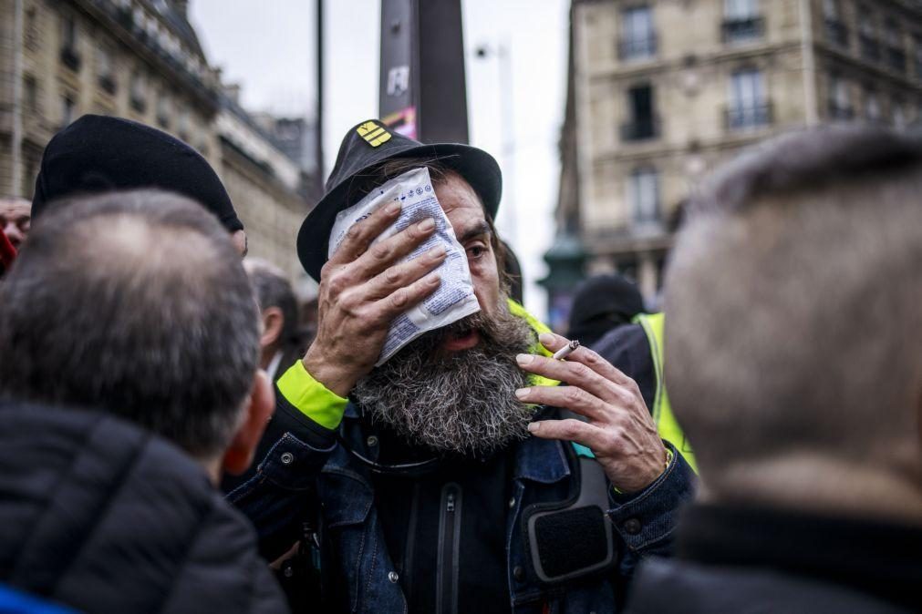 Polícias acusados por ferimentos contra 'colete amarelo' Jérôme Rodrigues