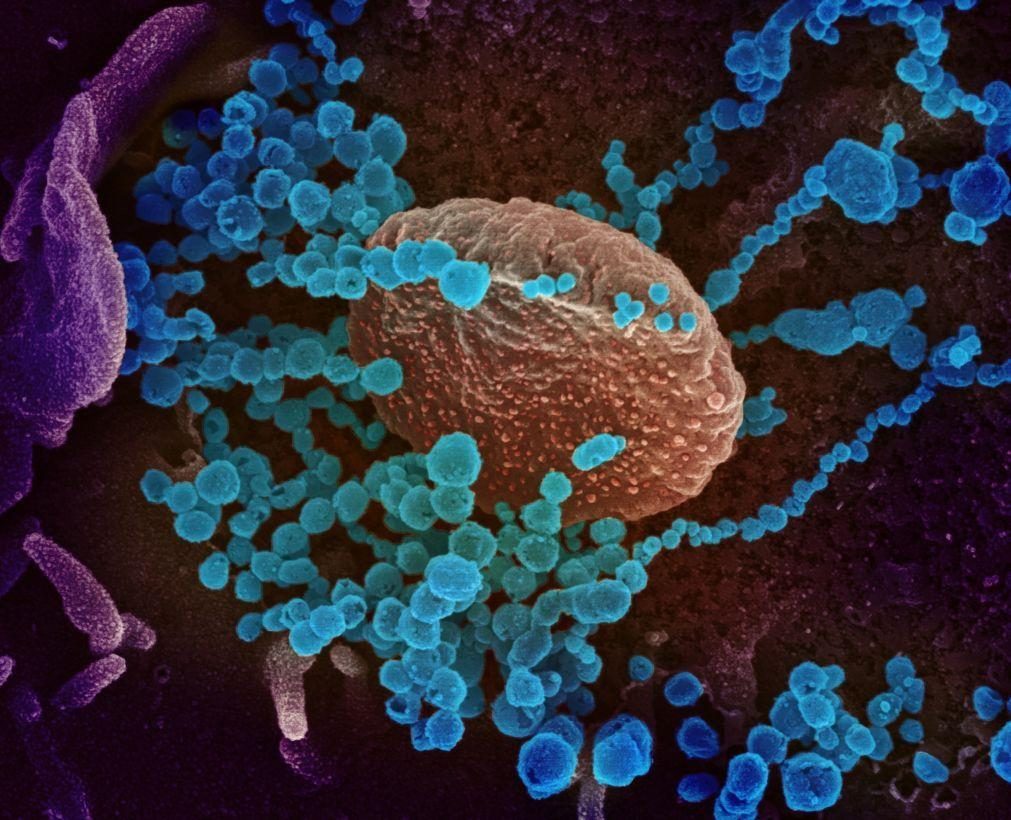 Covid-19: Anticorpos resultantes de infeções não impedem novas infeções com Ómicron